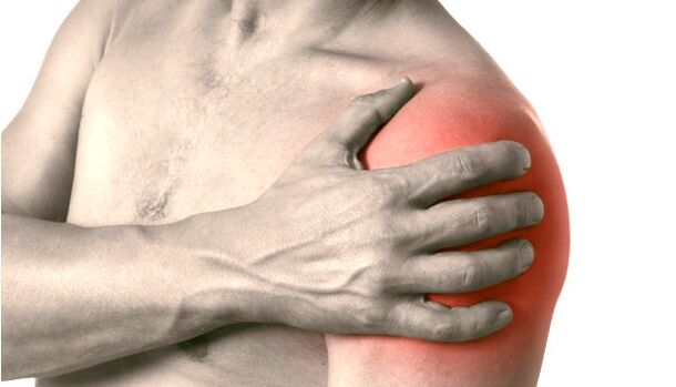 Подуто, зачервено и уголемено рамо - симптоми на артроза на раменната става 2-3 степен