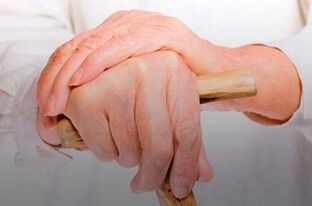 болка в ставите на пръстите при ревматоиден артрит