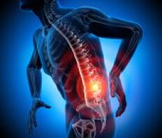 различни причини за болки в гърба