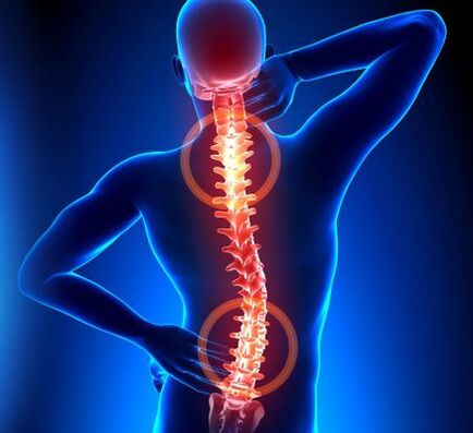 места на остеохондроза на гръбначния стълб